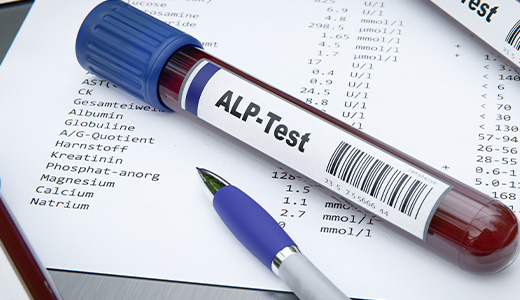 Alkaline Phosphatase (ALP) Test