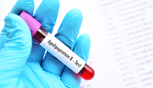 Apolipoprotein B Test