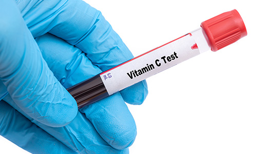 Vitamin C Test