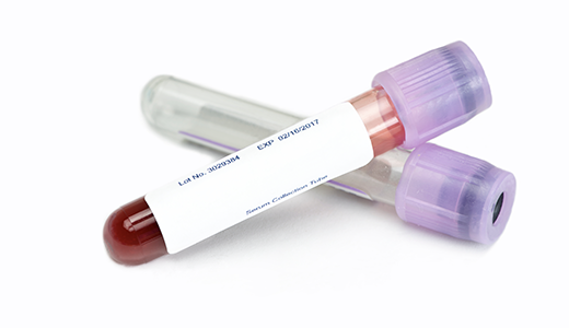 Hepatitis B Core Antibody, Total