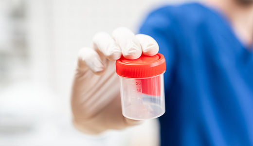 hCG, Qualitative, Urine