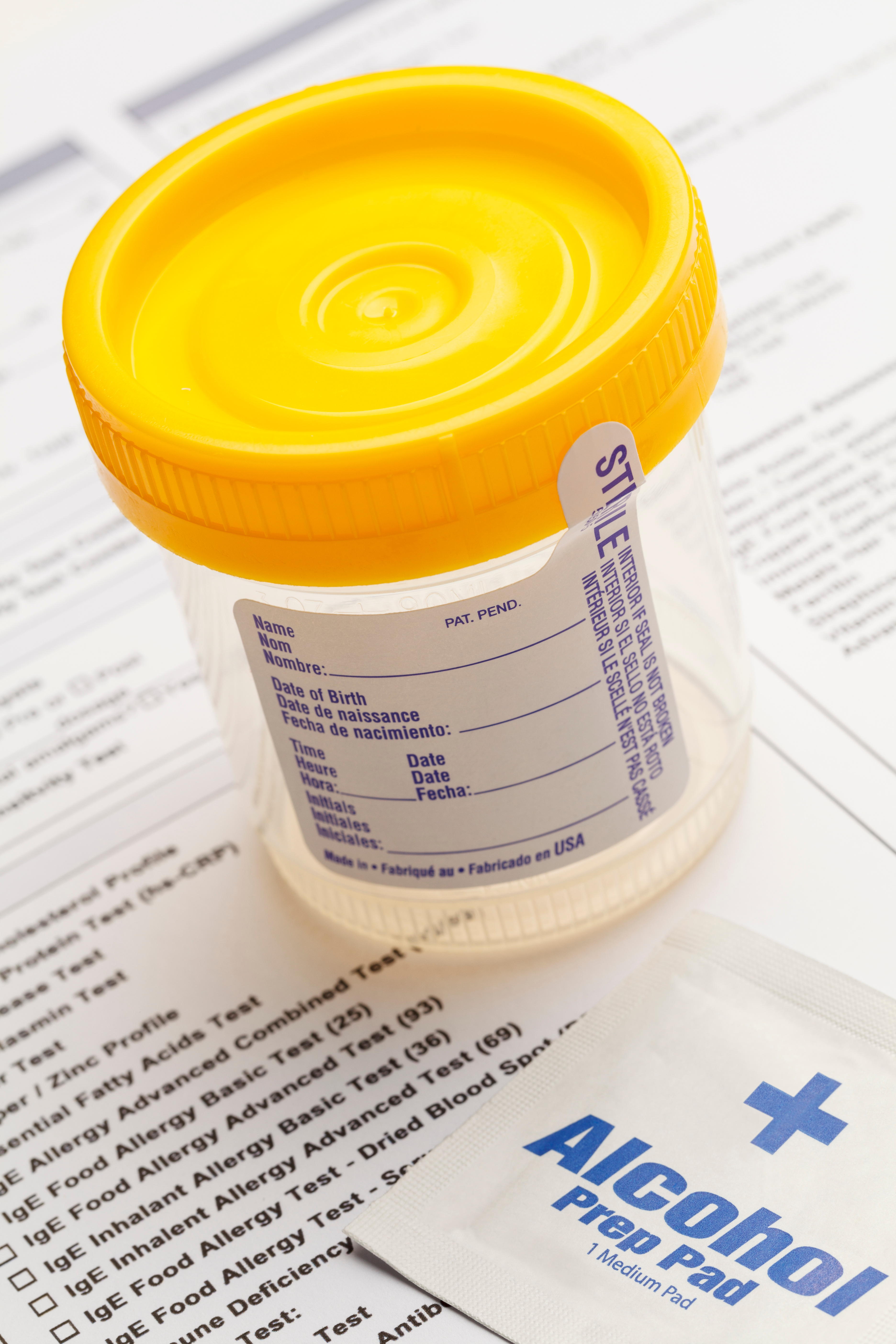 Cadmium, Random Urine