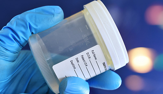 Heavy Metal Urine Panel (21Toxic/16 Nutritional), Urine