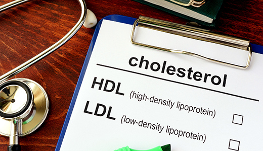 Total Cholesterol Test