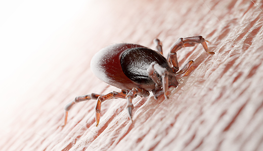 Lyme Disease Screening - Rapid Results